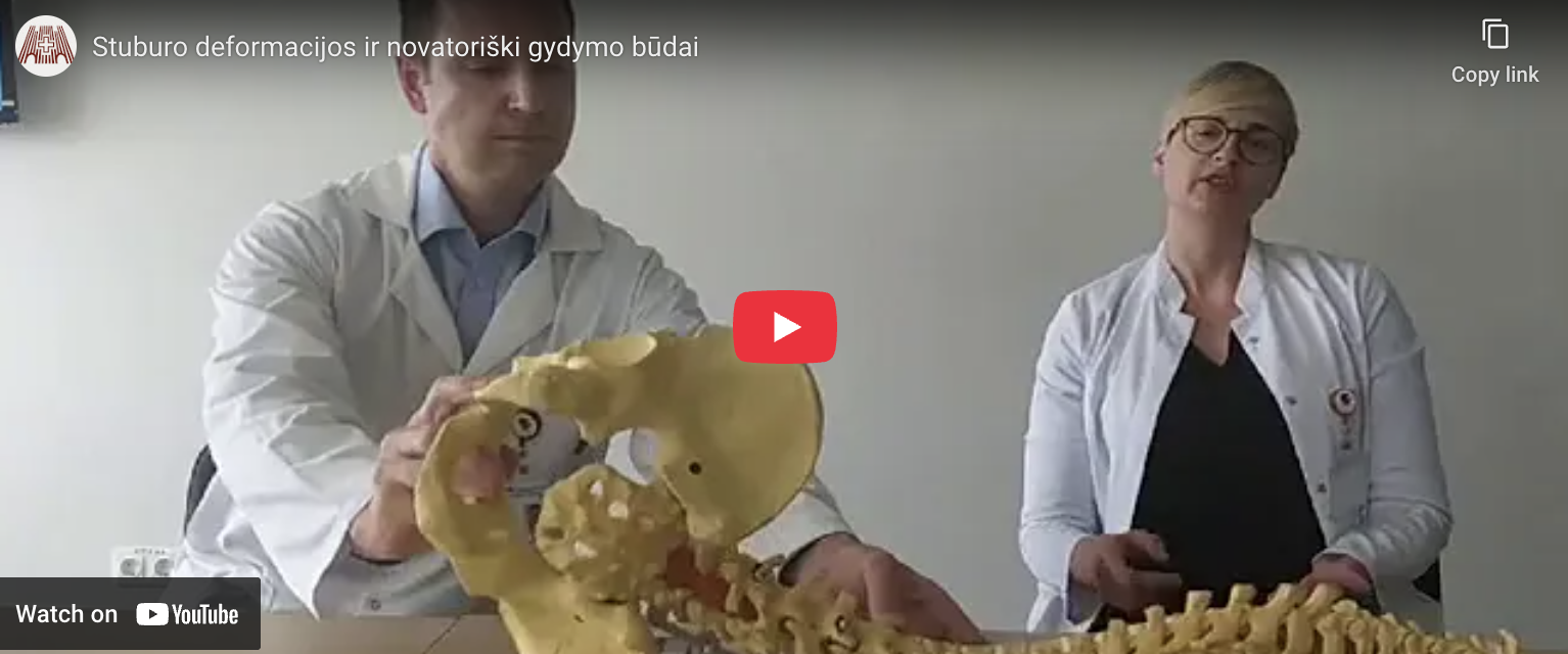 Stuburo deformacijos ir novatoriški gydymo būdai
